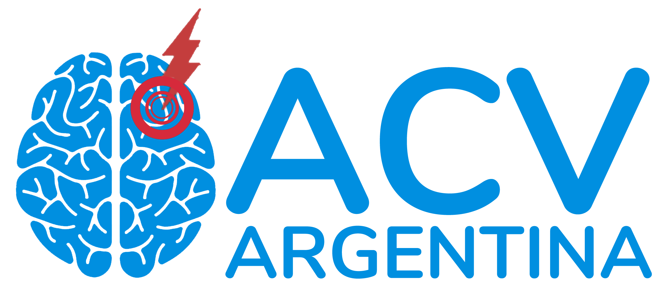 ACV Argentina